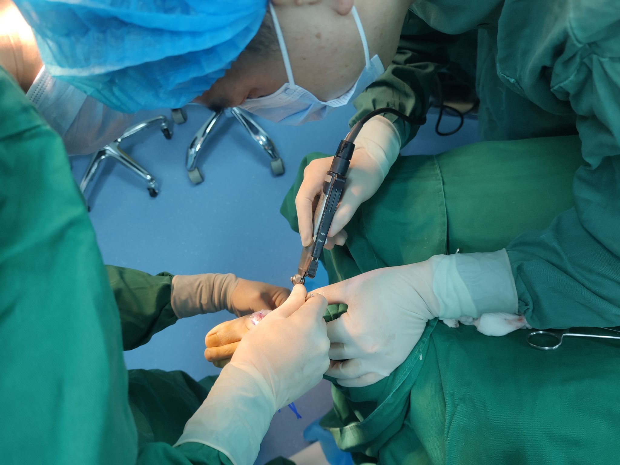 拇外翻手术治疗的4个关键问题_医学界-助力医生临床决策和职业成长